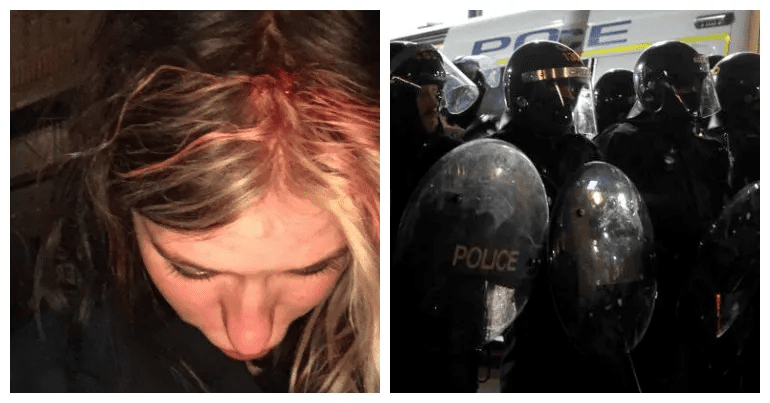 A picture of riot police, and of Fleur Moody's head injury
